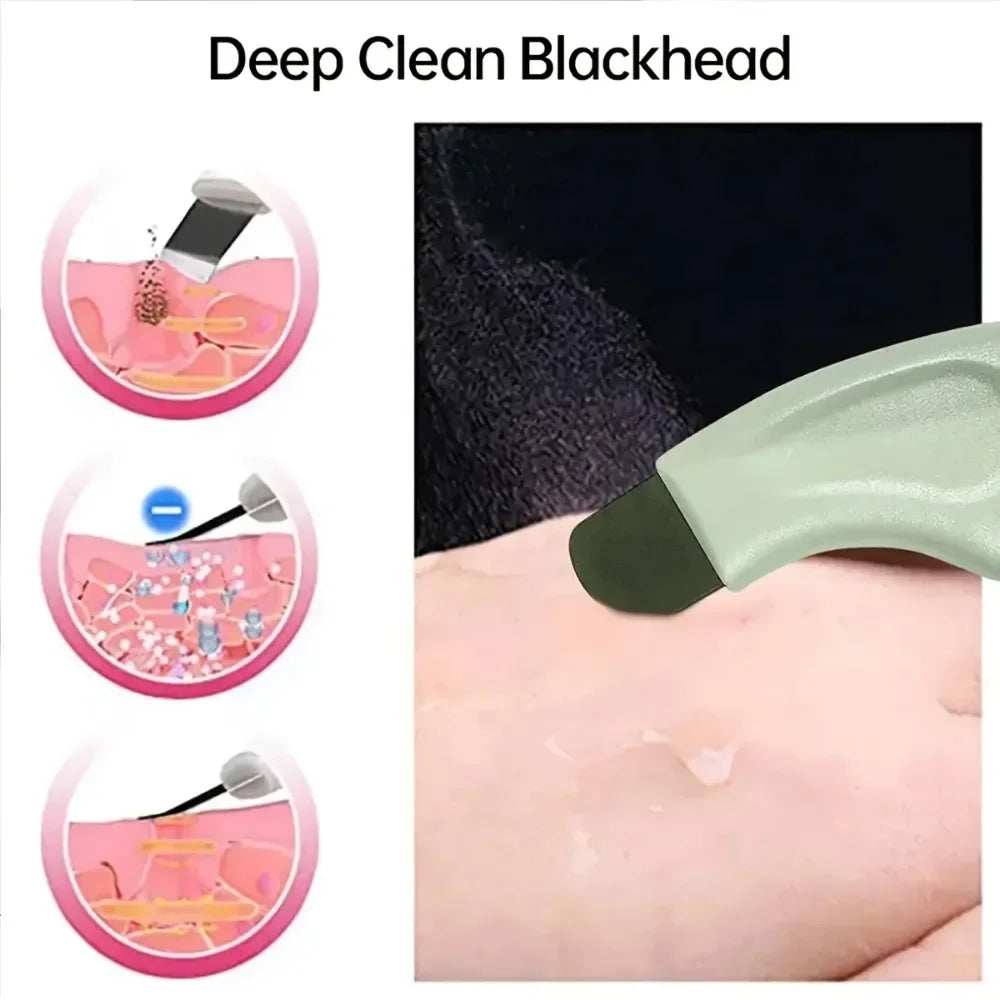 1 Piece Of Manual Blackhead Scraper, Blackhead Remover, Facial Beauty Tool For Removing Acne And Dead Skin
