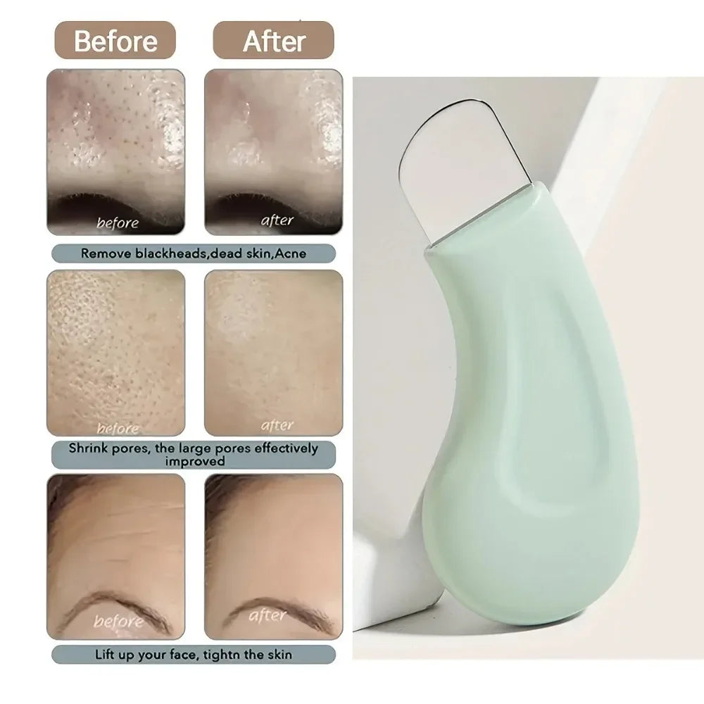 1 Piece Of Manual Blackhead Scraper, Blackhead Remover, Facial Beauty Tool For Removing Acne And Dead Skin