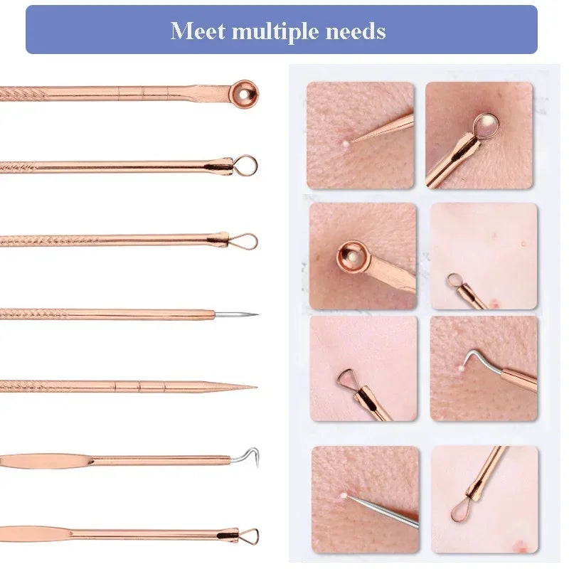 4Pcs Acne Blackhead Remover Tool Set Ultra Fine Pore Extractor Needles Facial Skin Cleansing Beauty Kit For Blemish Spot Whitehe