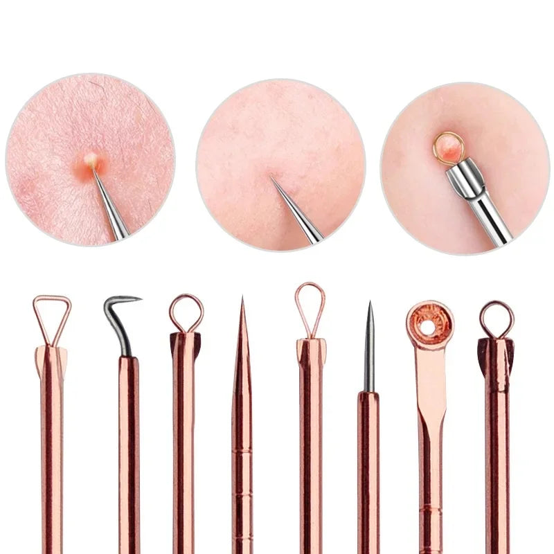 4Pcs Acne Blackhead Remover Tool Set Ultra Fine Pore Extractor Needles Facial Skin Cleansing Beauty Kit For Blemish Spot Whitehe